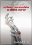 Jak leczyć reumatoidalne zapalenie stawów. Poradnik dla chorych